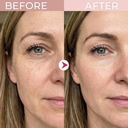 🔥Final 2 Hour 50% OFF🔥 LOVILDS Eye Renewal Cream