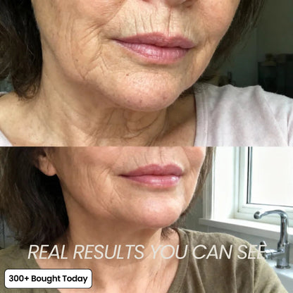 🔥 TODAY’S KLYVENA GLOW DEAL Klyvena Korean Pink Collagen Volume Multi Balm