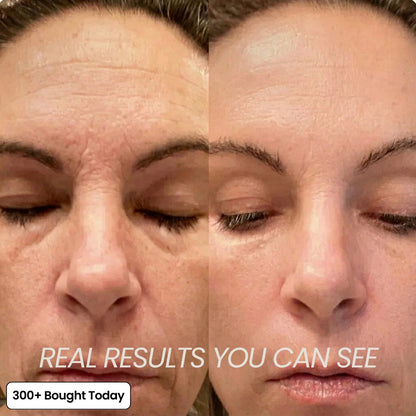 🔥 TODAY’S KLYVENA GLOW DEAL Klyvena Korean Pink Collagen Volume Multi Balm