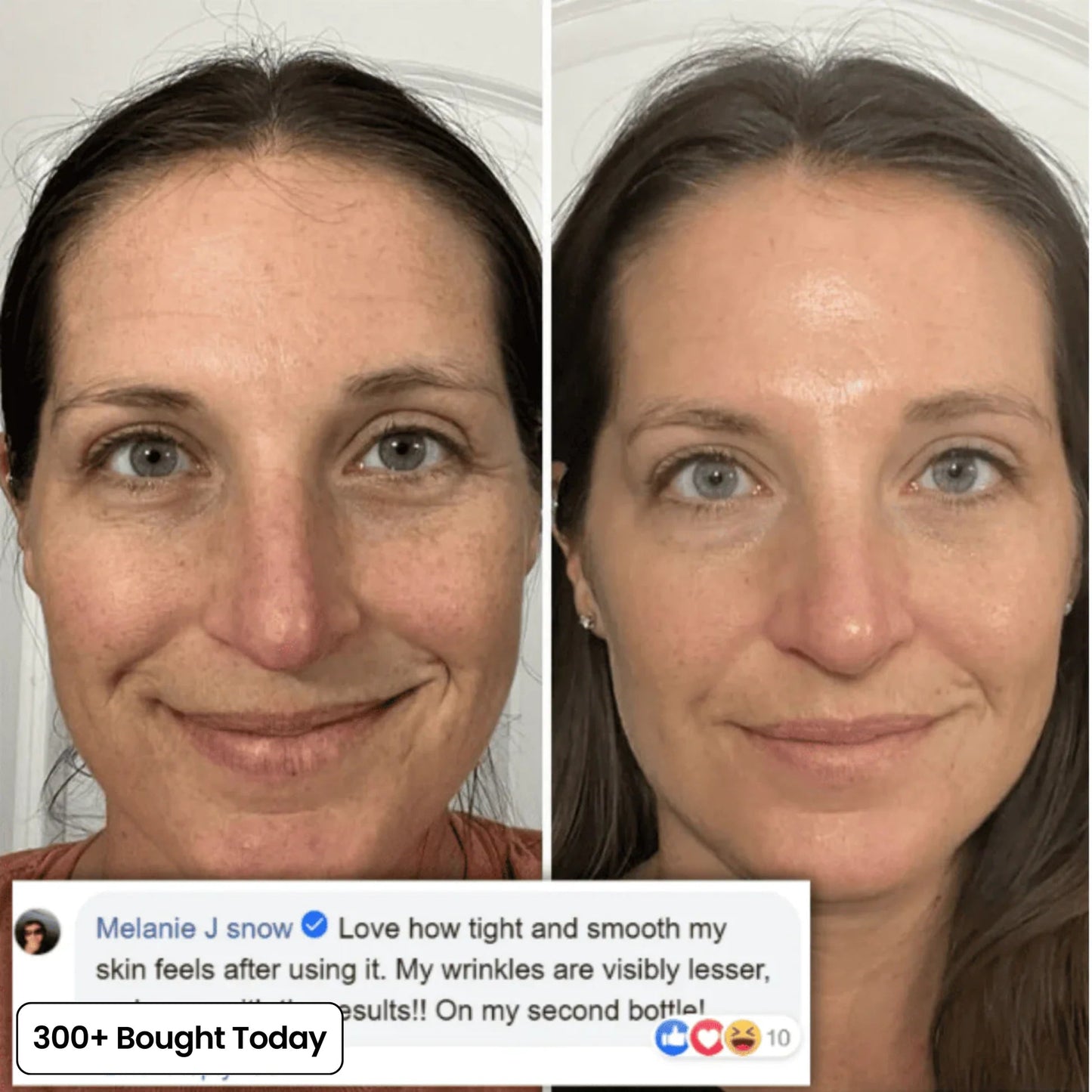 🔥 TODAY’S KLYVENA GLOW DEAL Klyvena Korean Pink Collagen Volume Multi Balm