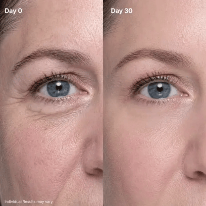 🔥Final 2 Hour 50% OFF🔥 LOVILDS Eye Renewal Cream